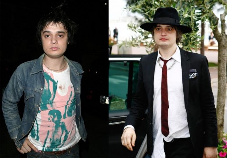PETE DOHERTY