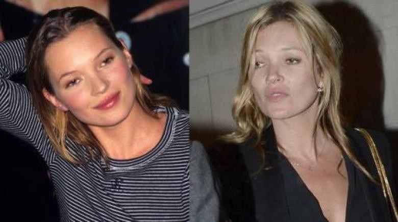 KATE MOSS